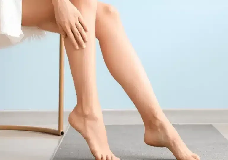 Can Varicose Veins be Inherited?